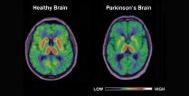 Biology Seminar - Mechanisms and Models of Dominant Parkinson's Disease